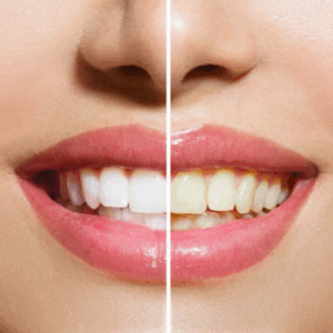 Teeth whitening icon