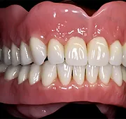 Complete Denture Replacement of Oral Cavity